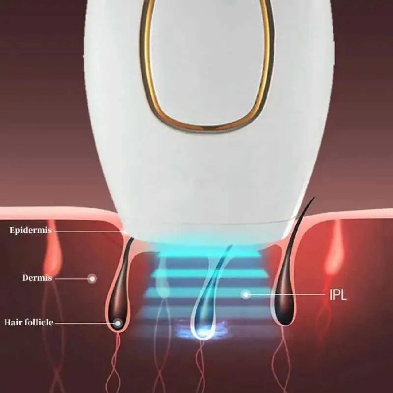 IPLStar, dispozitiv de epilare cu laser - Image 9