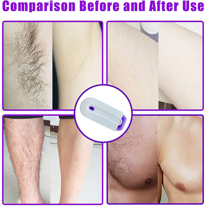 SmoothTouch, dispozitiv de ras pentru femei - Image 7
