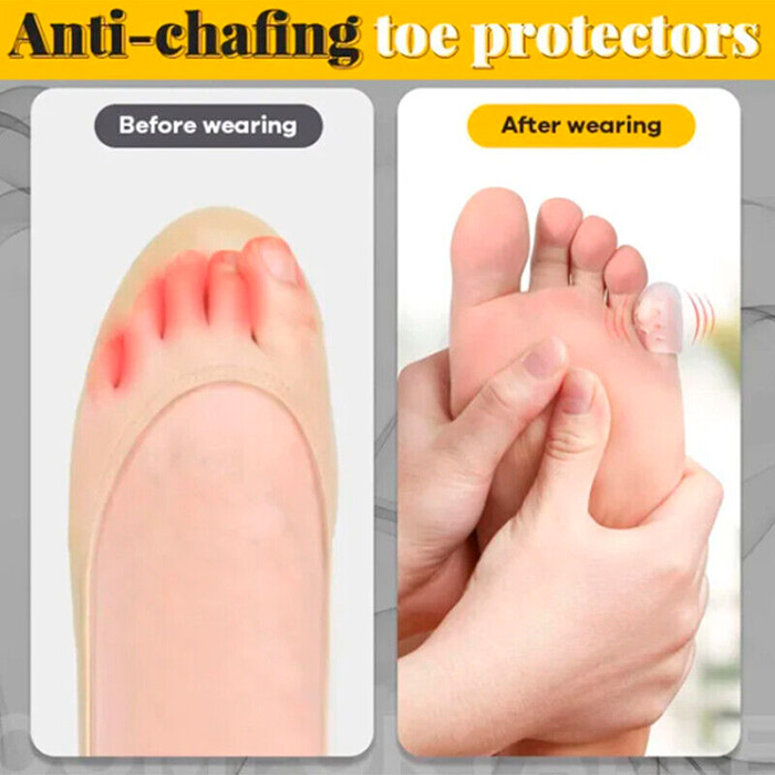 ToeProtector, protecții pentru degete din silicon (set de 10 bucăți) - Image 5