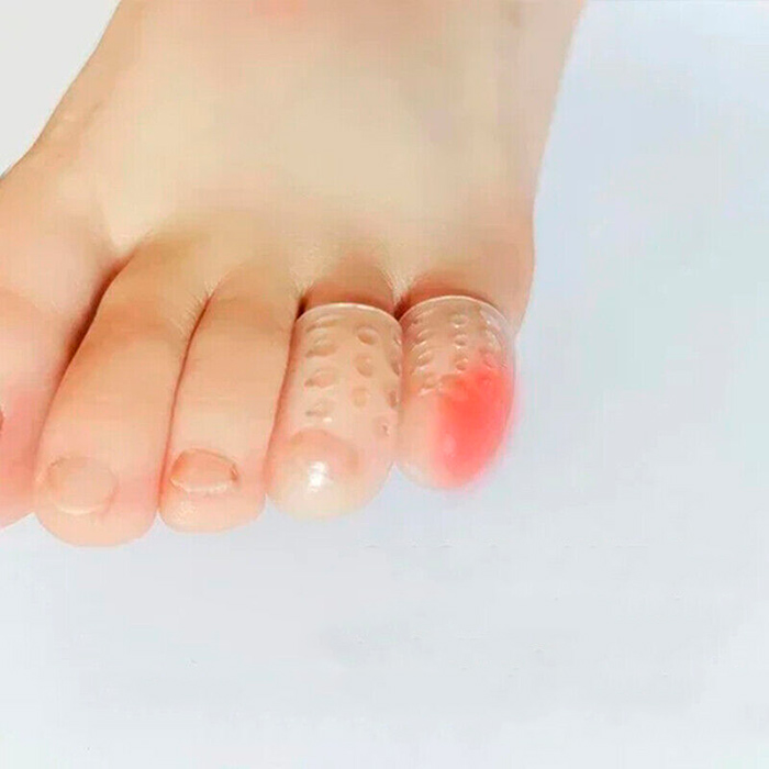 ToeProtector, protecții pentru degete din silicon (set de 10 bucăți) - Image 8